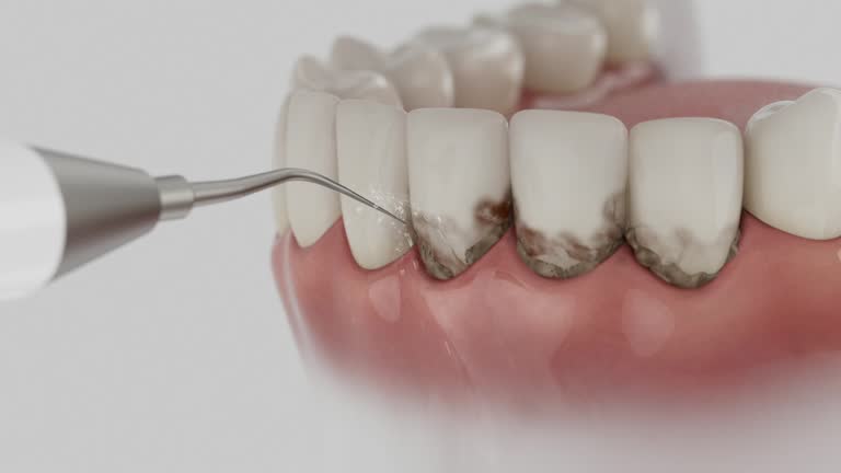 Reliable Dental contractor in Honaker, VA by Smile Center Dentistry